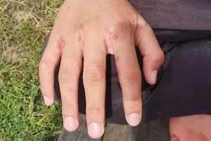 Santri Waspada Ini Dia Penyakit yang Sering Mengintai dan Cara Menghindarinya